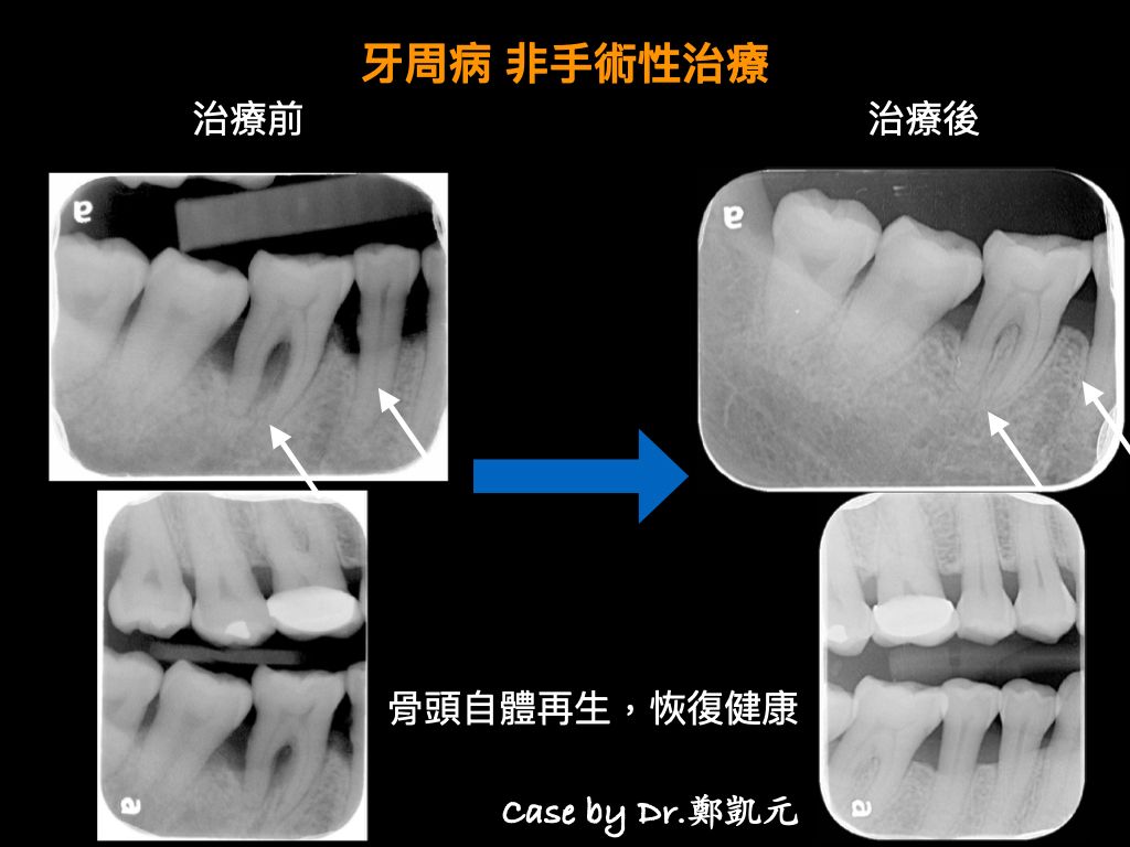 bravodental101