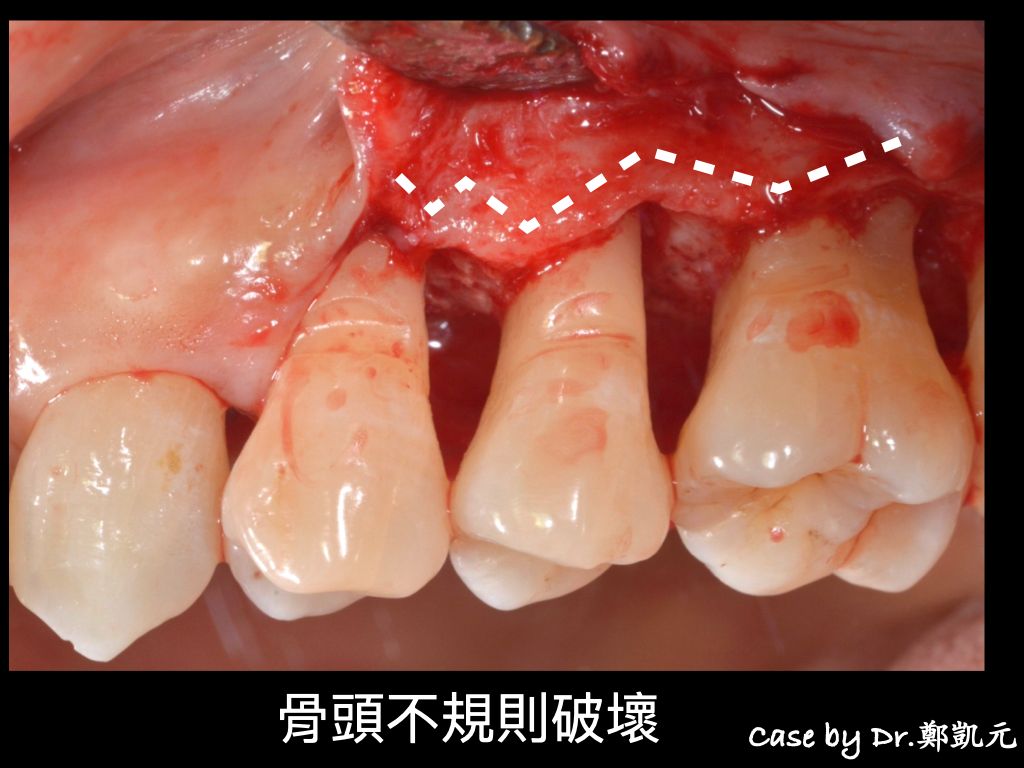 bravodental101