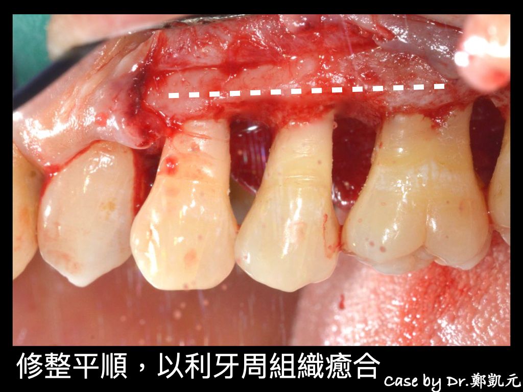 bravodental101