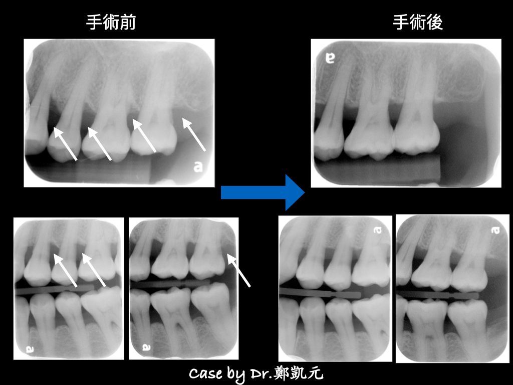 bravodental101