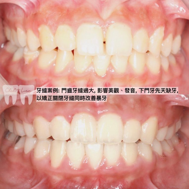 bravodental101