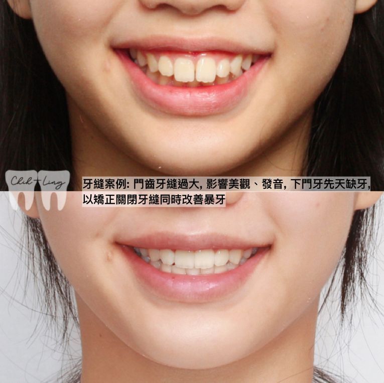bravodental101
