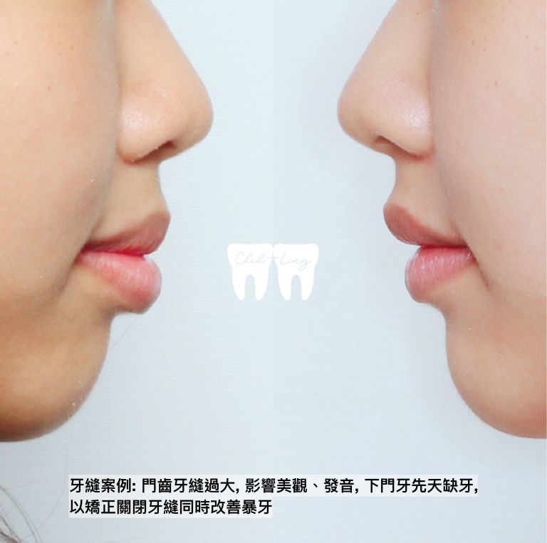 bravodental101