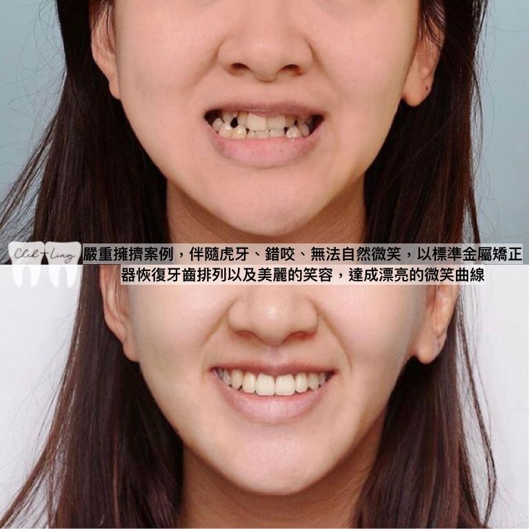 bravodental101