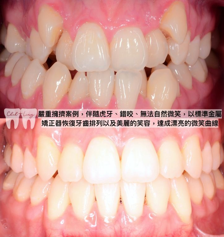 bravodental101