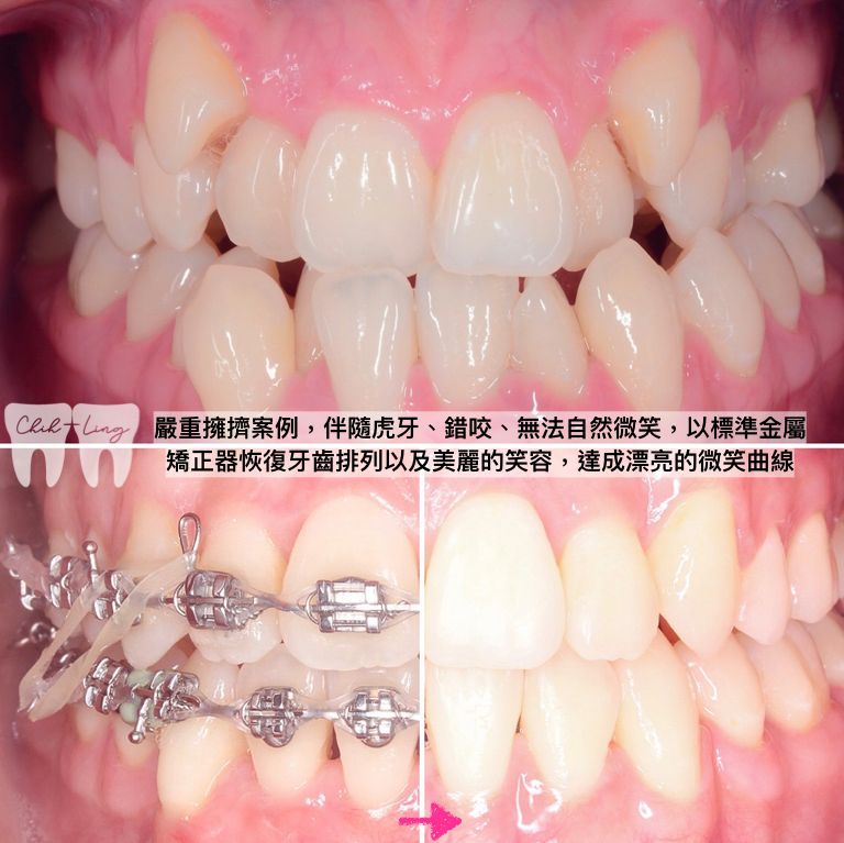 bravodental101