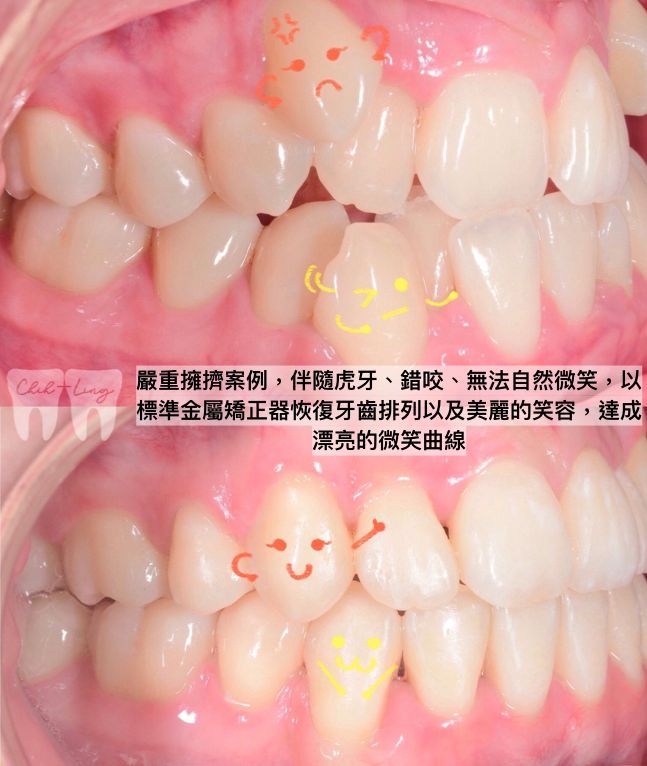 bravodental101