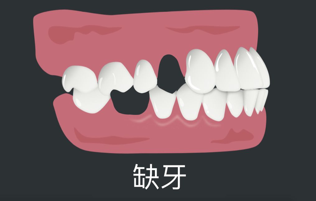 bravodental101