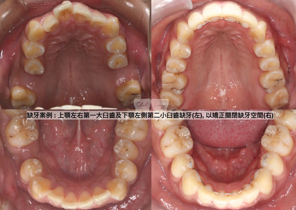 bravodental101