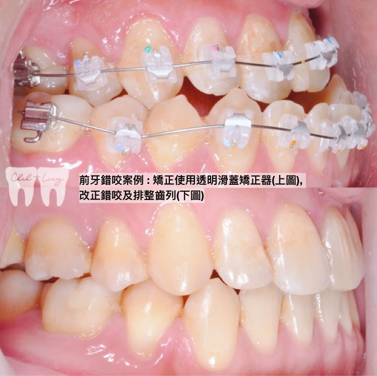 bravodental101