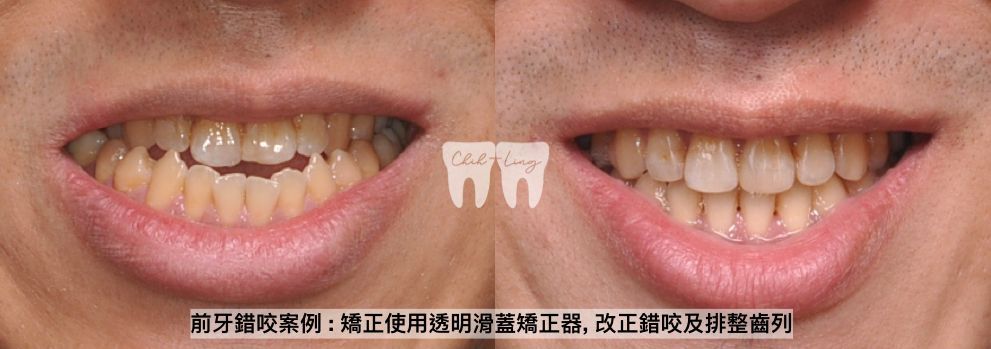 bravodental101