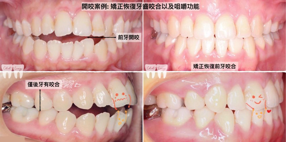bravodental101