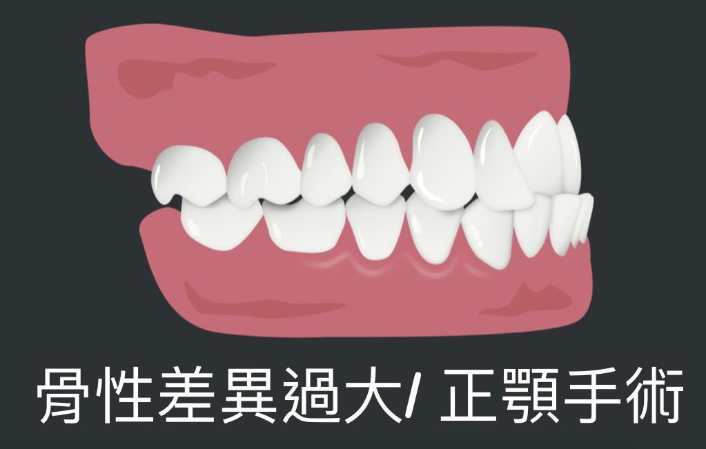 bravodental101