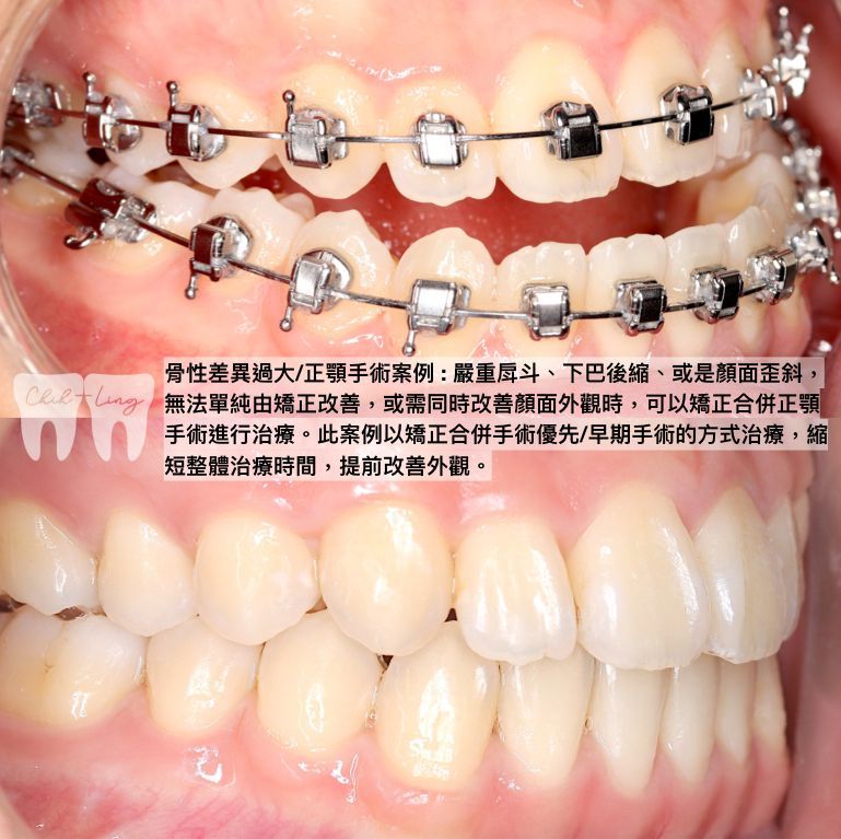 bravodental101