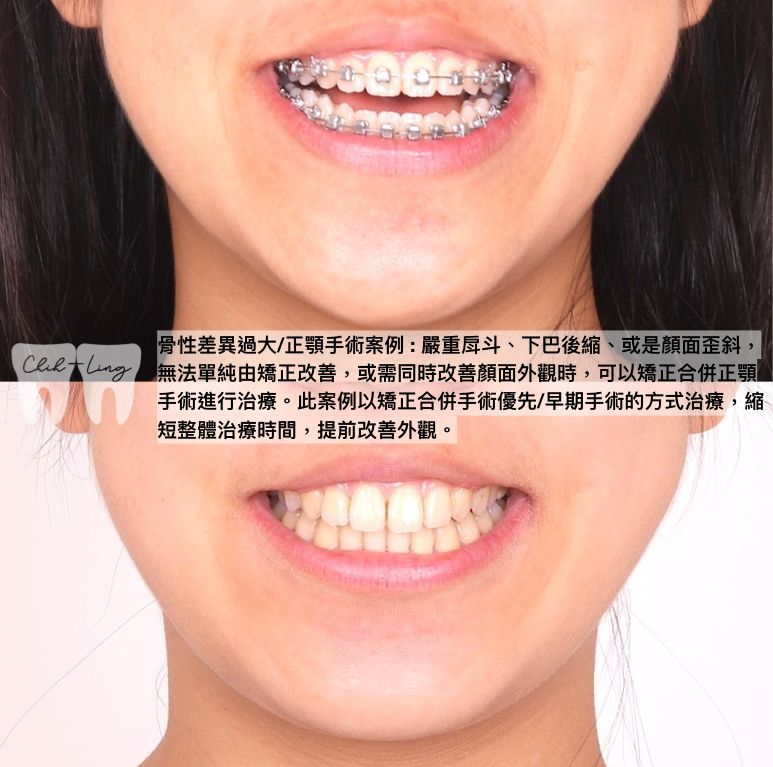 bravodental101