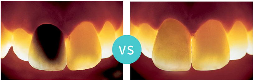 bravodental101