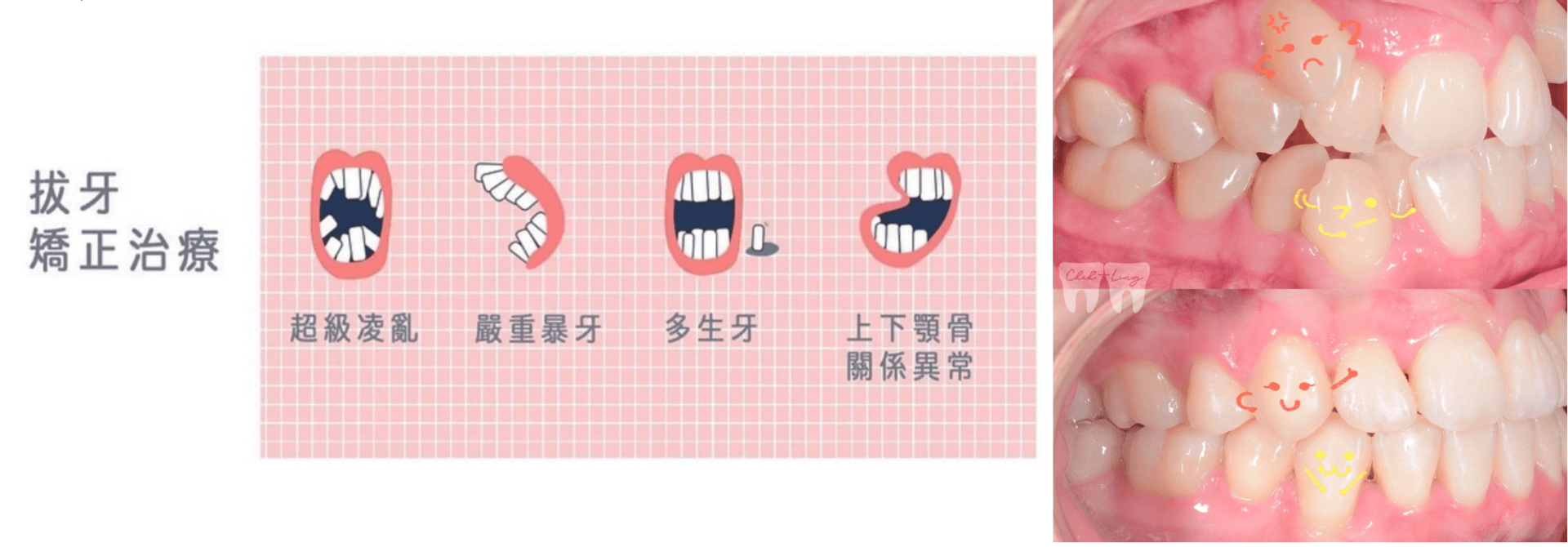 bravodental101