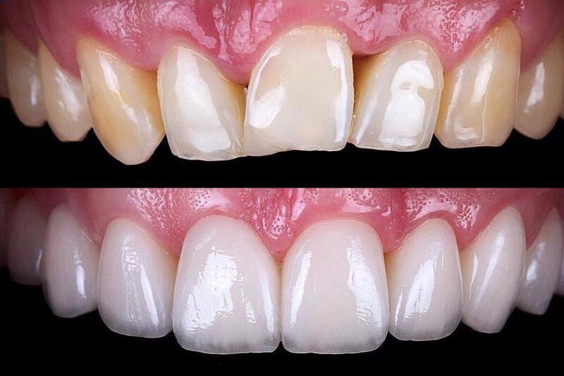 bravodental101