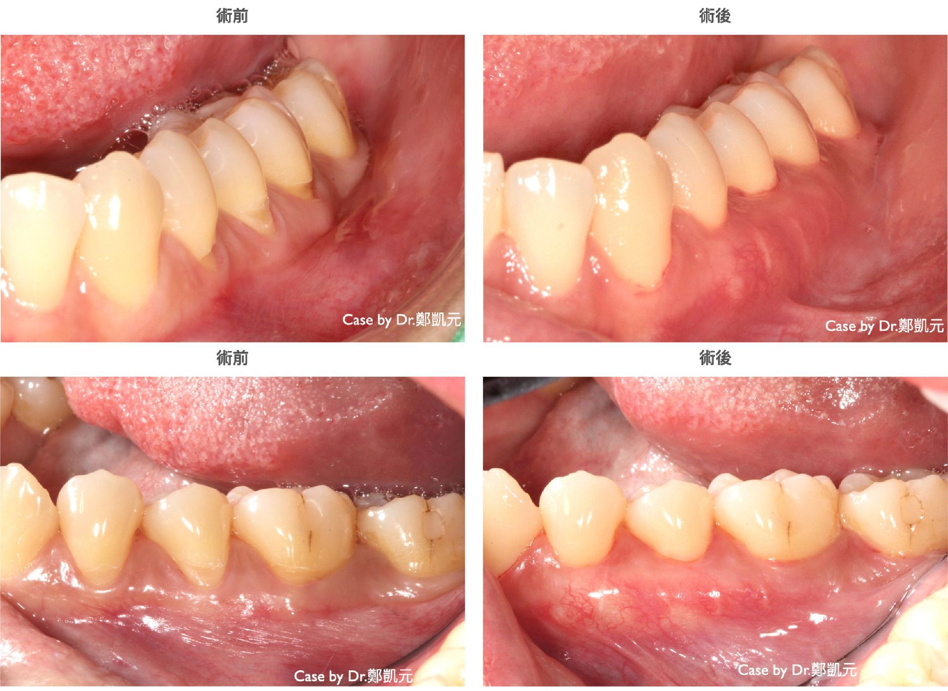 bravodental101