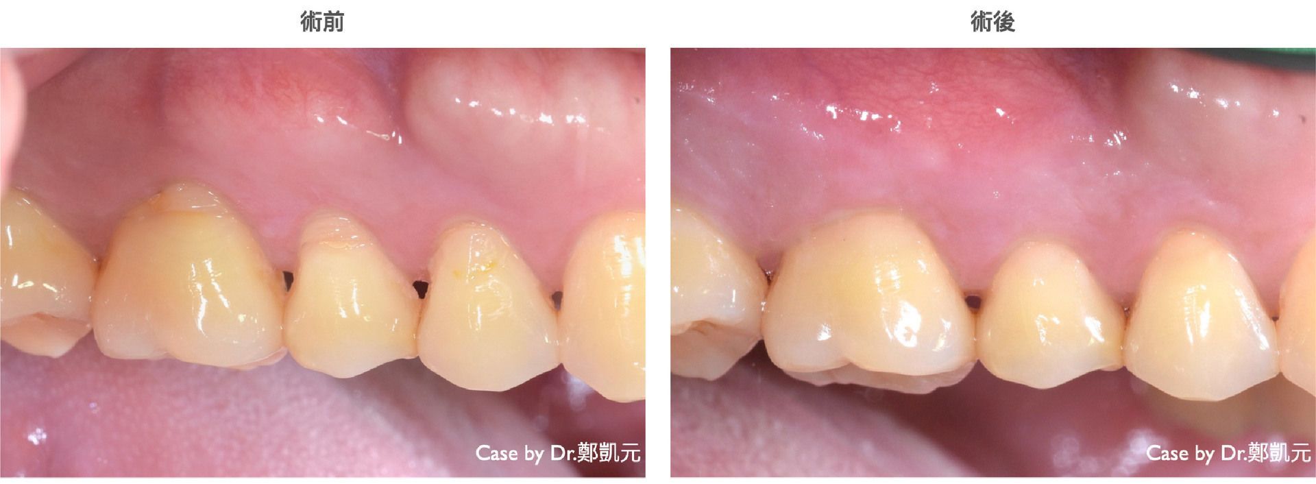 bravodental101