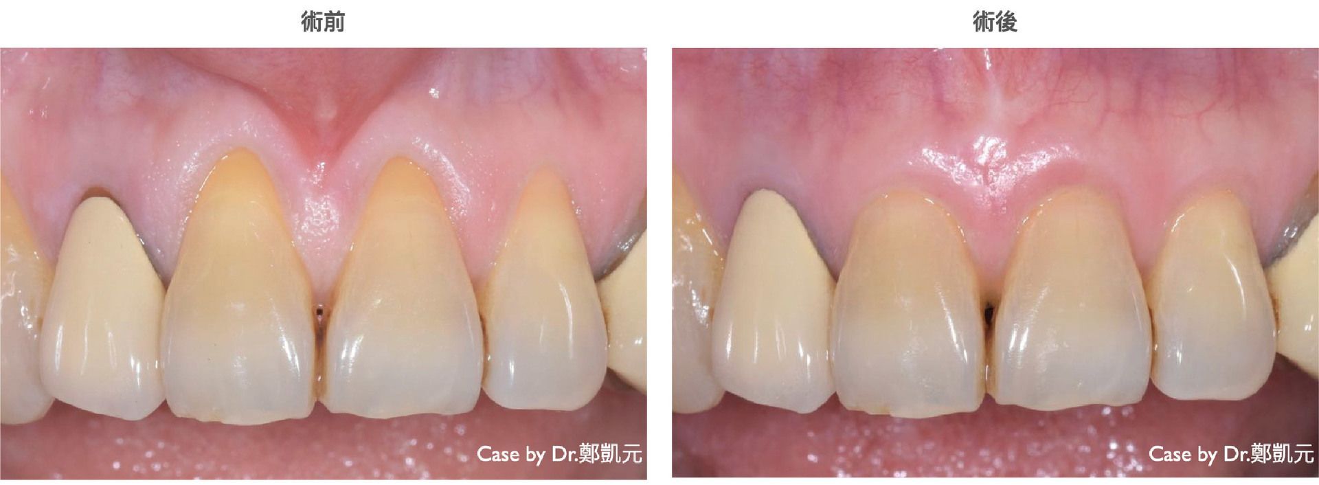 bravodental101