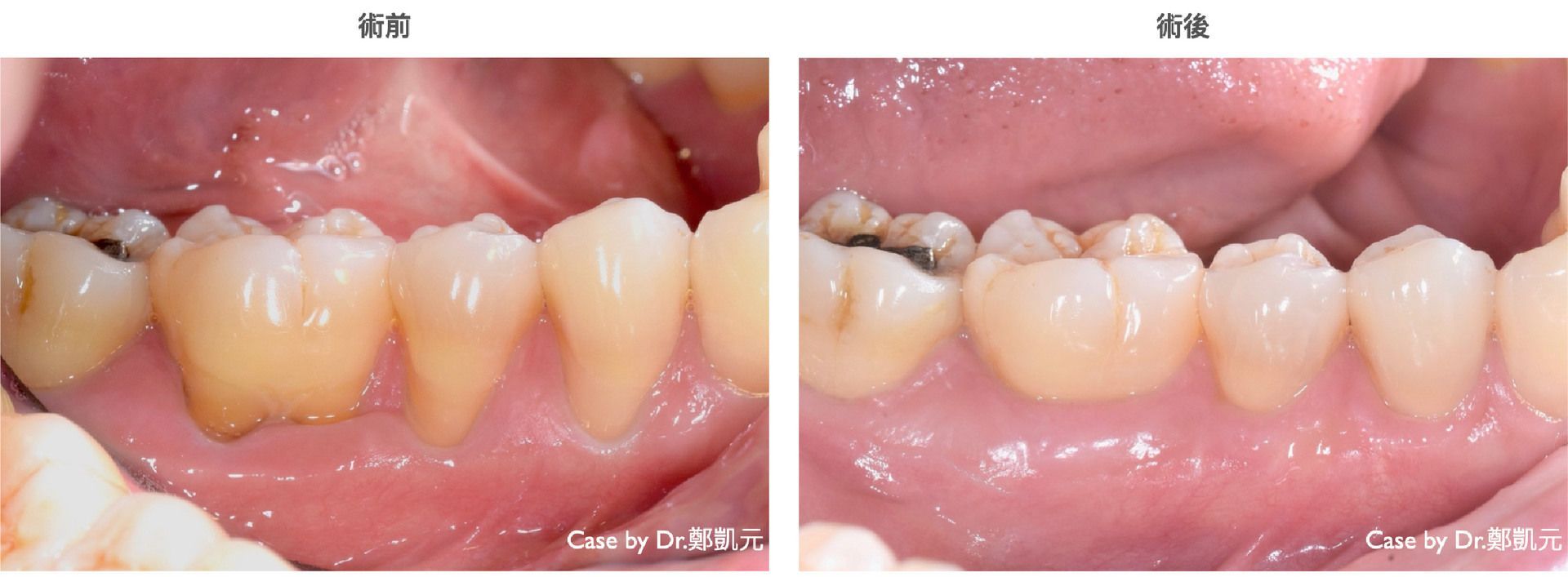 bravodental101