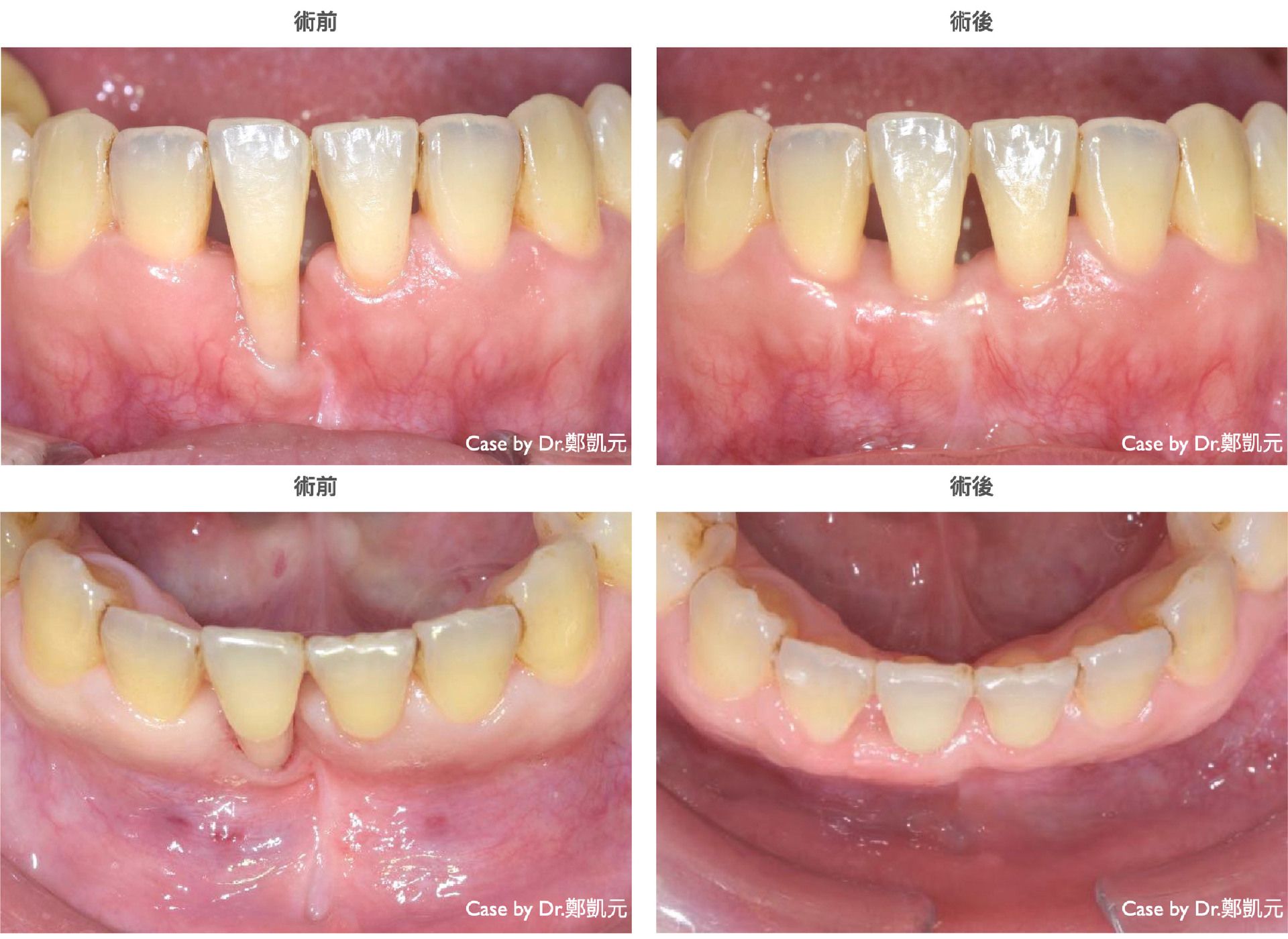 bravodental101