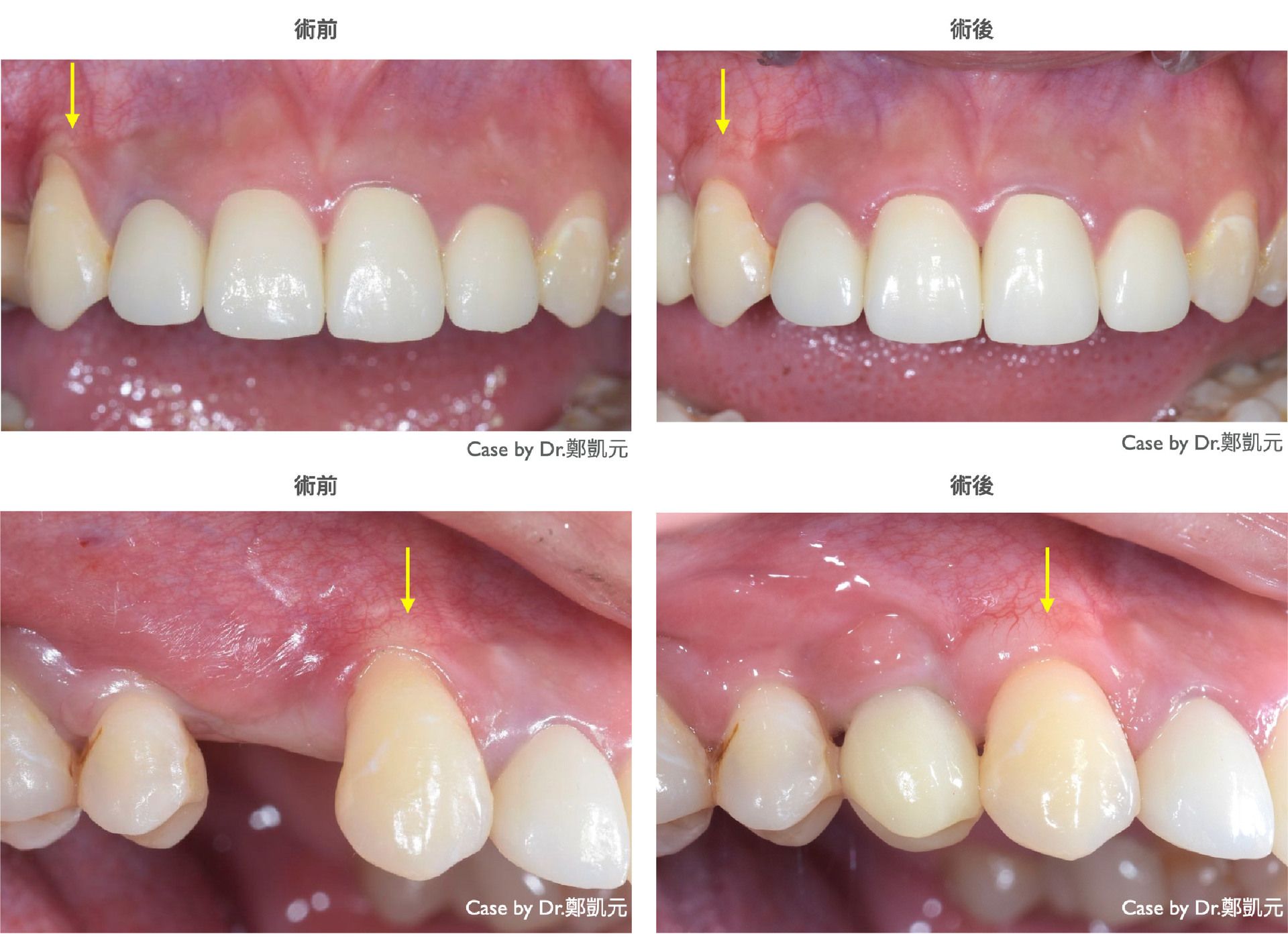 bravodental101