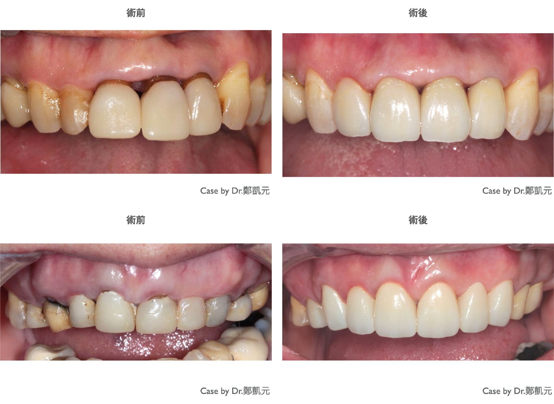 bravodental101