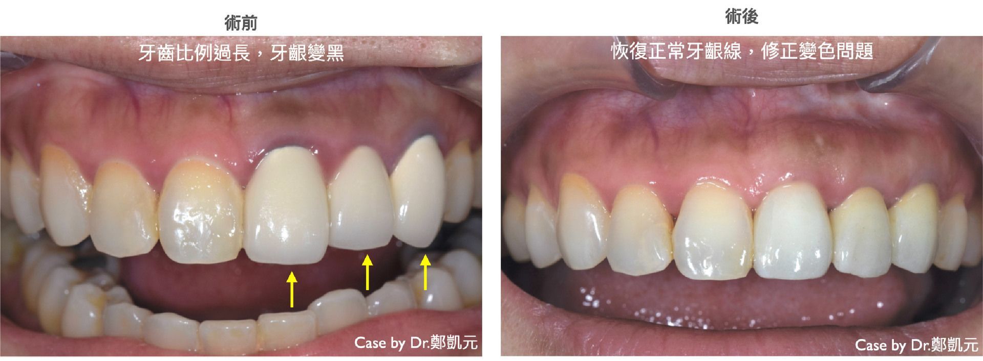 bravodental101