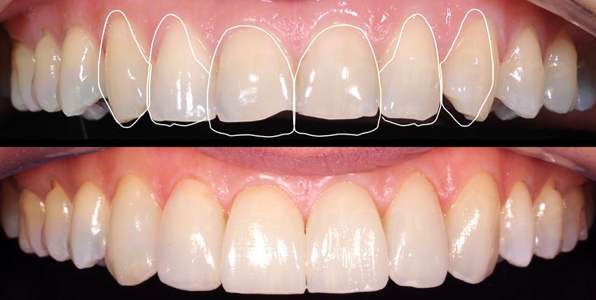 bravodental101