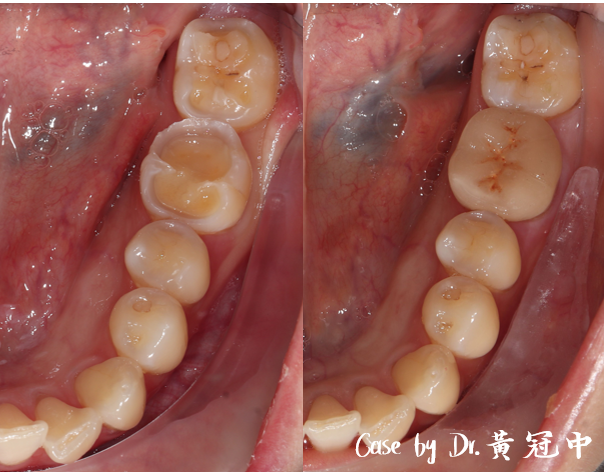 bravodental101.