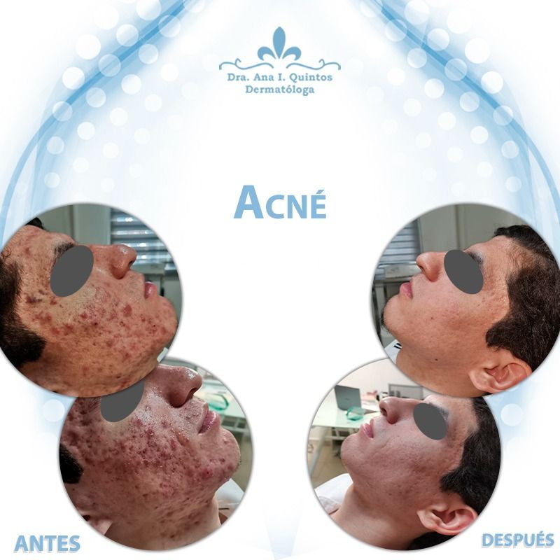 Dra. Ana Quintos - DERMATOLOGA