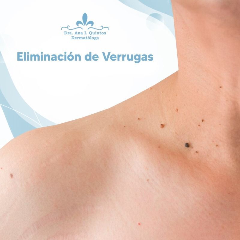 Dra. Ana Quintos - DERMATOLOGA