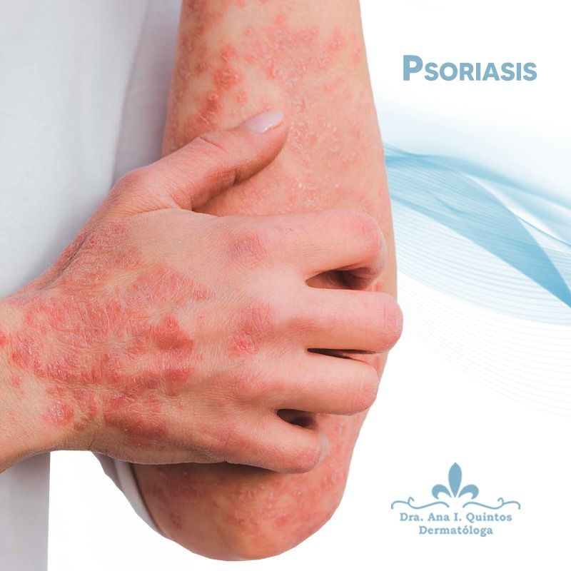 Dra. Ana Quintos - DERMATOLOGA
