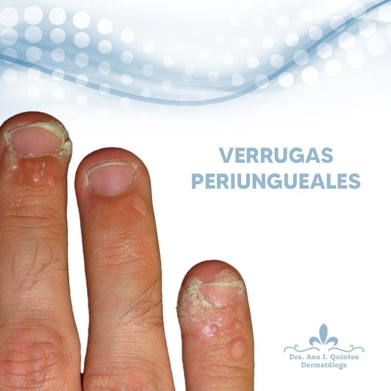 Dra. Ana Quintos - DERMATOLOGA
