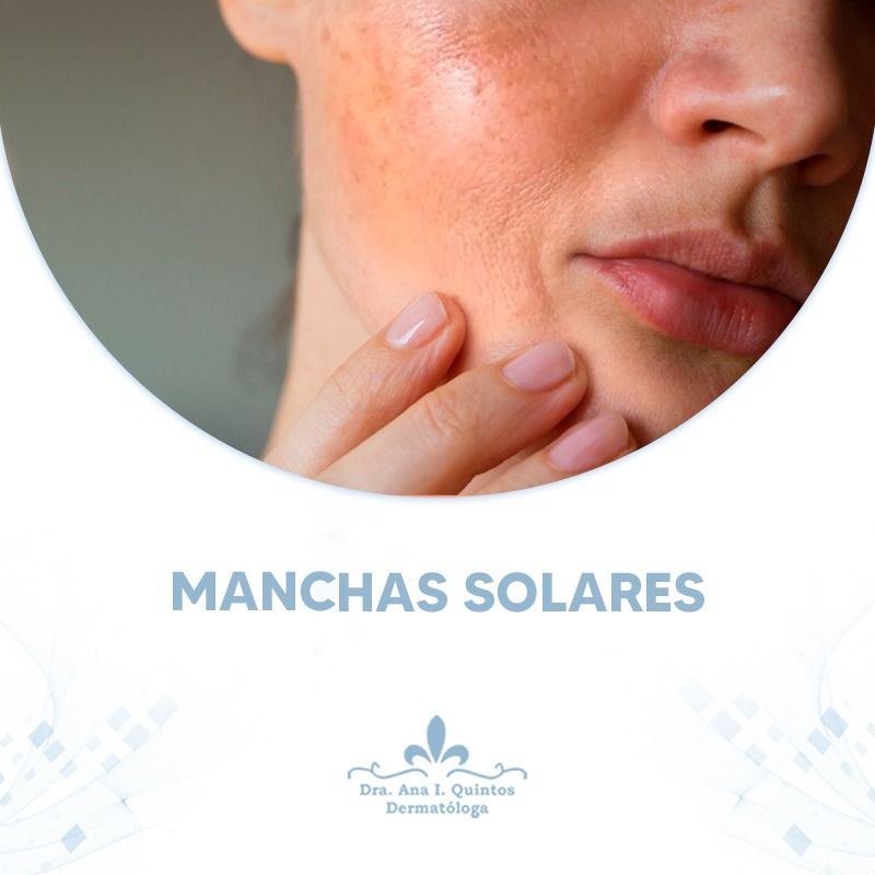 Dra. Ana Quintos - DERMATOLOGA