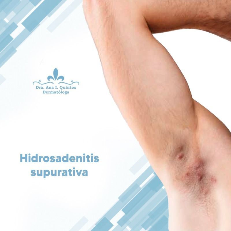 Dra. Ana Quintos - DERMATOLOGA
