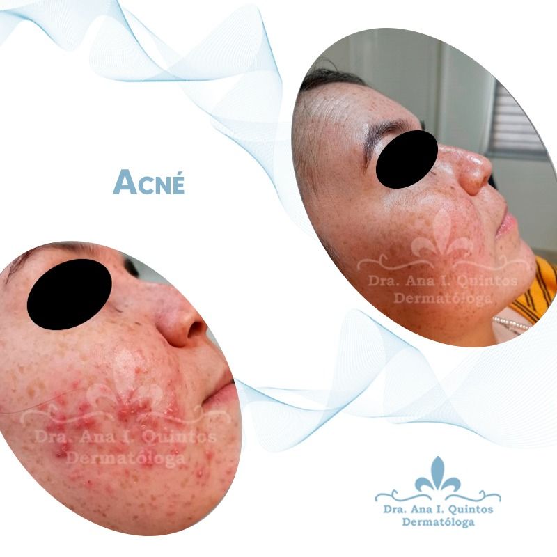 Dra. Ana Quintos - DERMATOLOGA