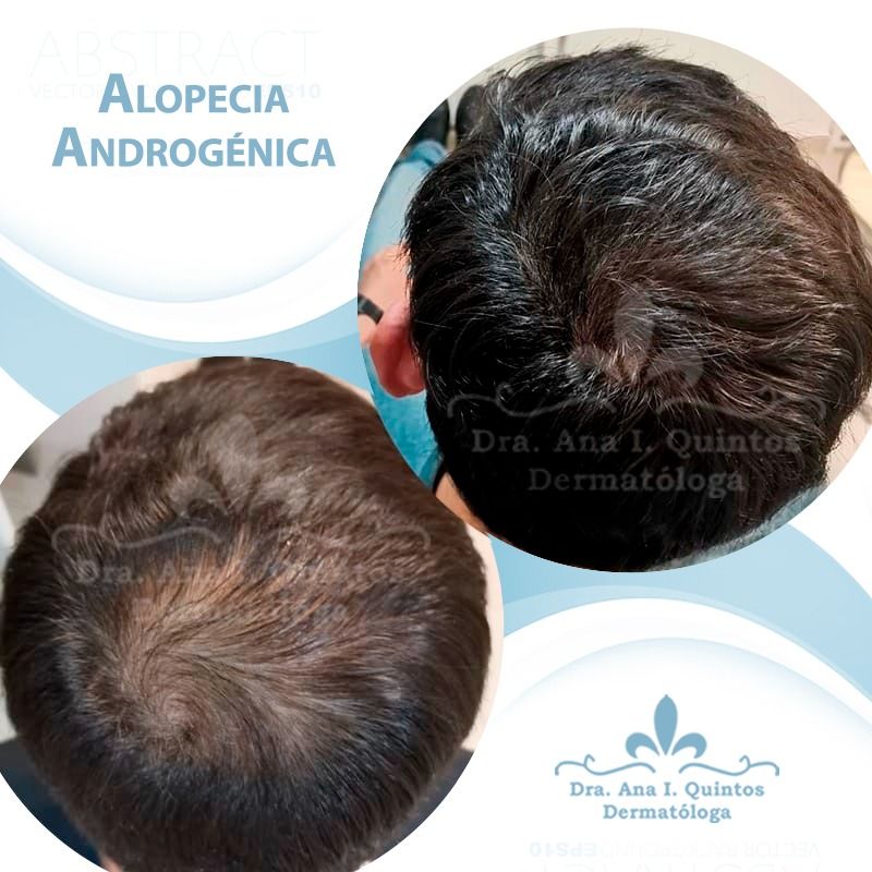Dra. Ana Quintos - DERMATOLOGA
