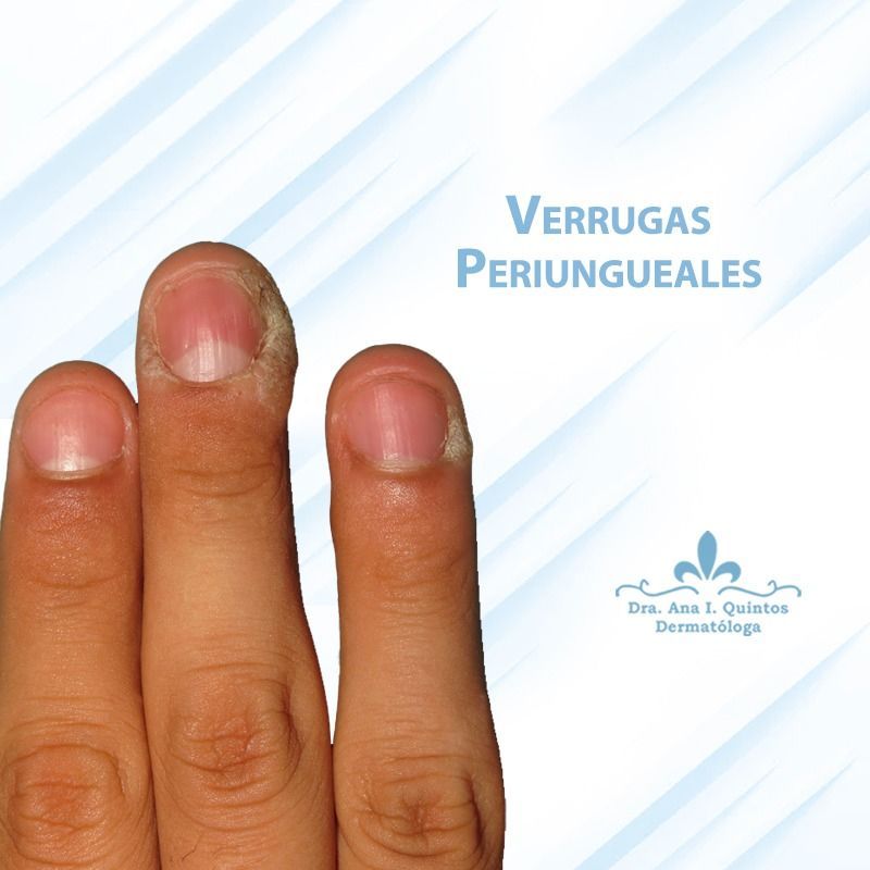 Dra. Ana Quintos - DERMATOLOGA