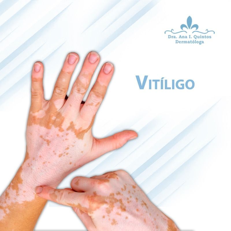 Dra. Ana Quintos - DERMATOLOGA