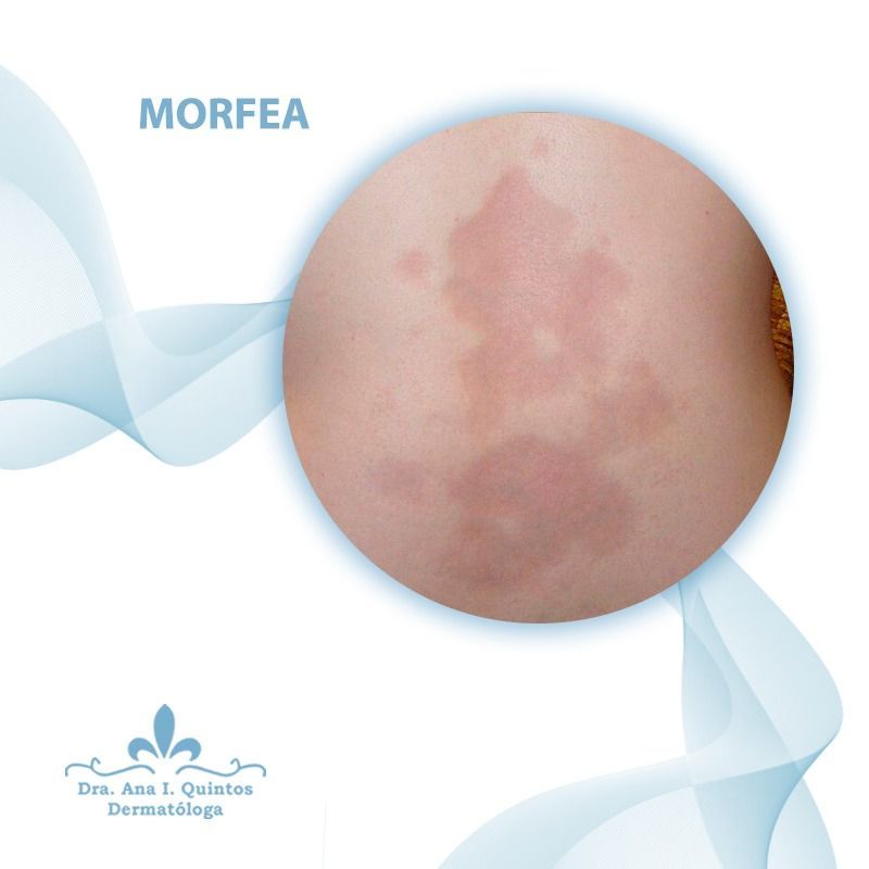 Dra. Ana Quintos - DERMATOLOGA