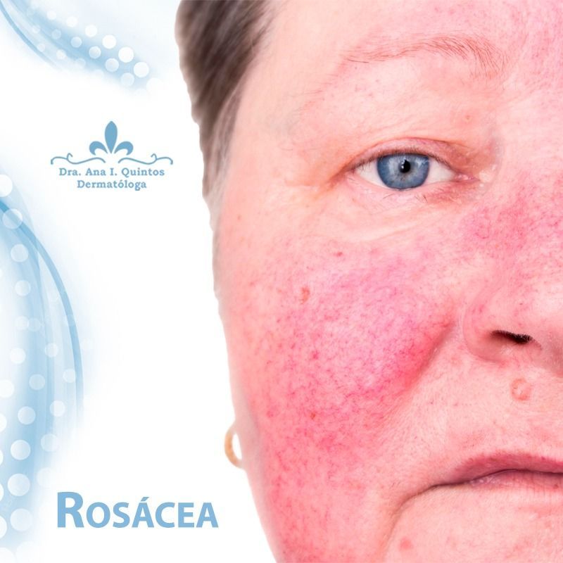 Dra. Ana Quintos - DERMATOLOGA