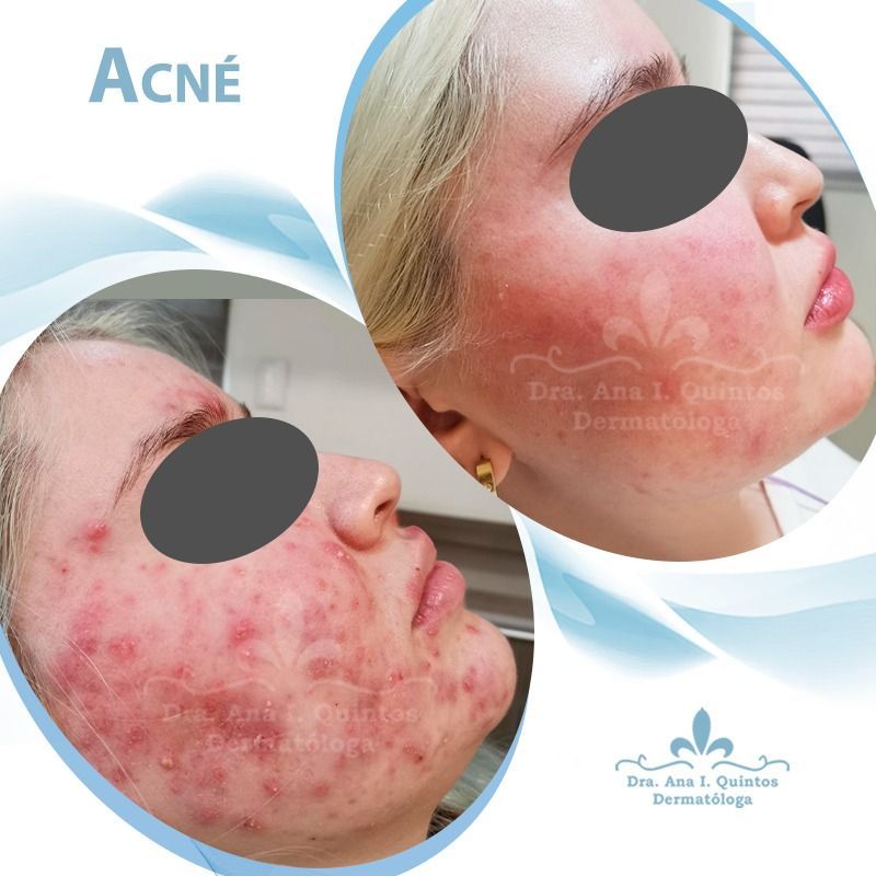 Dra. Ana Quintos - DERMATOLOGA