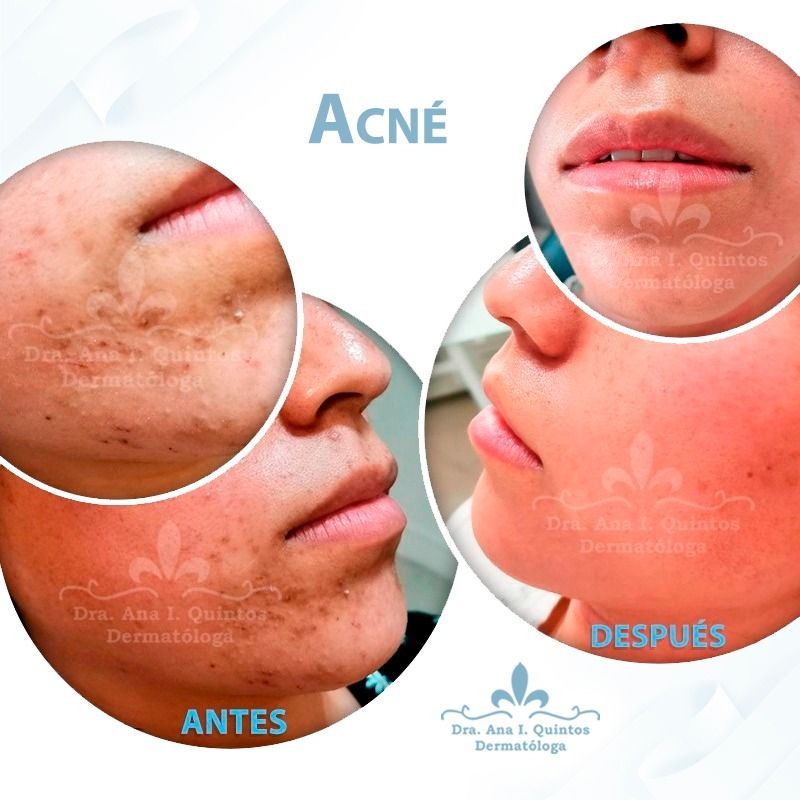 Dra. Ana Quintos - DERMATOLOGA