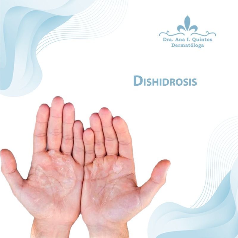 Dra. Ana Quintos - DERMATOLOGA