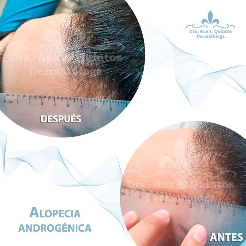 Dra. Ana Quintos - DERMATOLOGA