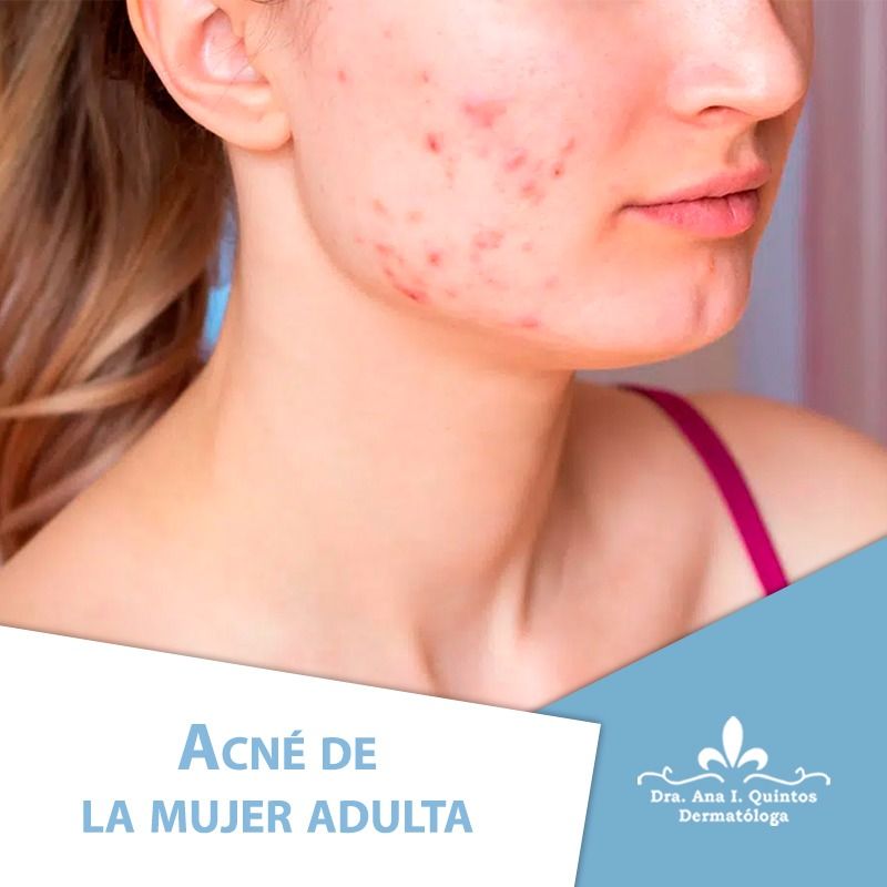Dra. Ana Quintos - DERMATOLOGA