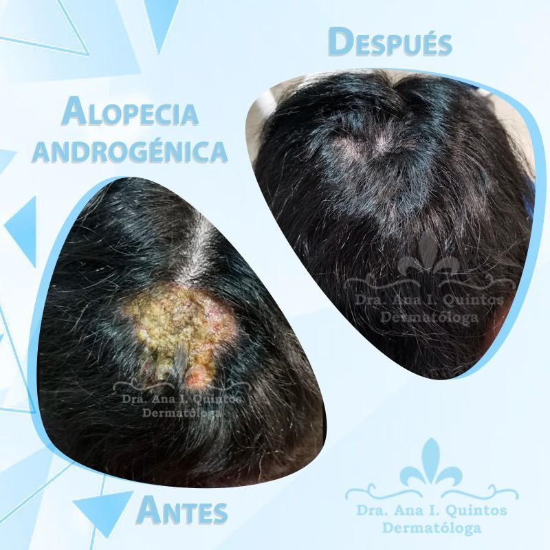 Dra. Ana Quintos - DERMATOLOGA